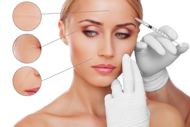 Hyaluronsäure-Injektionen für das Gesicht (Lippen, unter den Augen, Stirn). Vor und nach Fotos