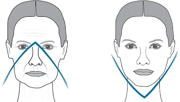 Come rimuovere le guance cascanti, stringere l'ovale del viso in 1 giorno. Esercizio, dieta, cura
