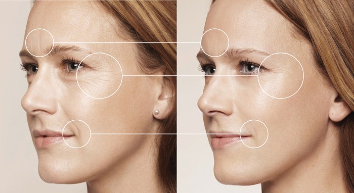 Contorn de la cara: què és, etapes, característiques, resultats del procediment