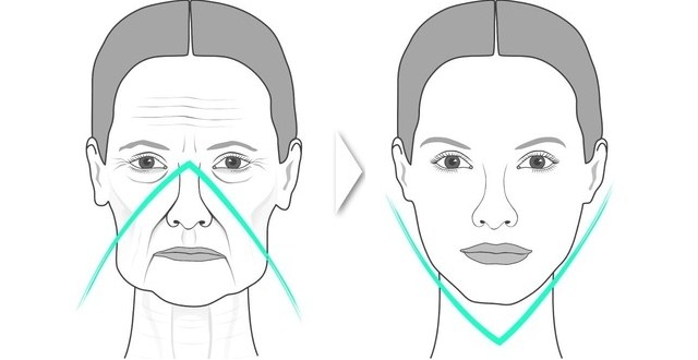 Ansiktskonturering - vad är det, steg, funktioner, resultat av proceduren