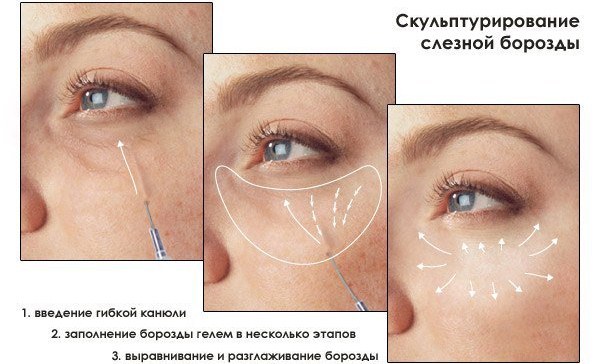 Contorn de la cara: què és, etapes, característiques, resultats del procediment