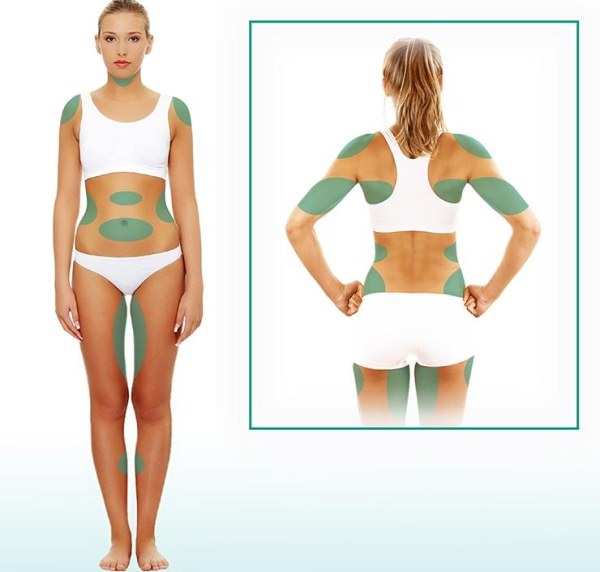 Liposuction badan. Berapa, harga, sebelum dan selepas foto, video, ulasan