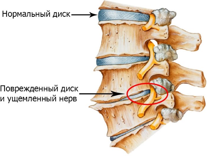 Esercizi del Dr. Shishonin per il collo con osteocondrosi. Complesso di ginnastica, video