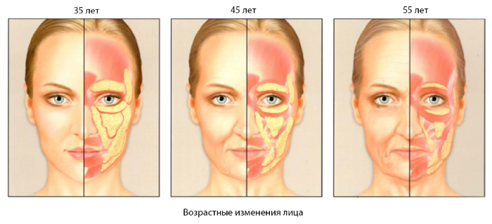 Wat is lipofilling? Lipofilling van het gezicht, borsten, billen, prijs, voor en na foto's
