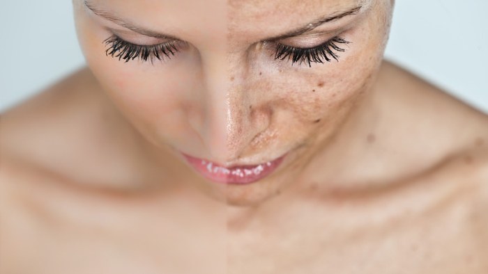 Co je chemický peeling na obličej