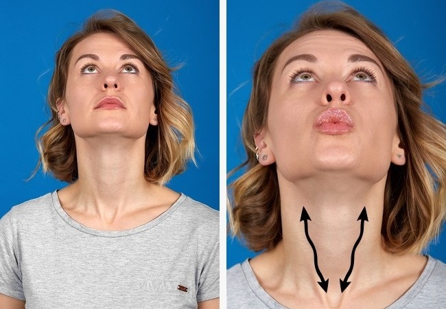 Ansiktslyftning för ansiktet - övningar, kirurgi, ansiktslyftning
