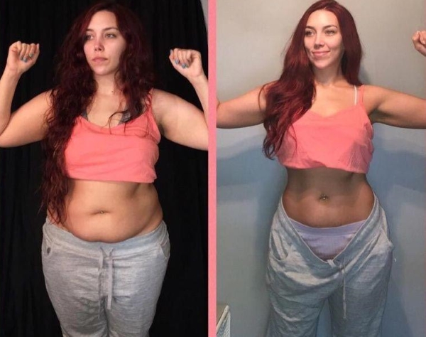Liposuction perut - jenis, gambar sebelum dan selepas, ulasan