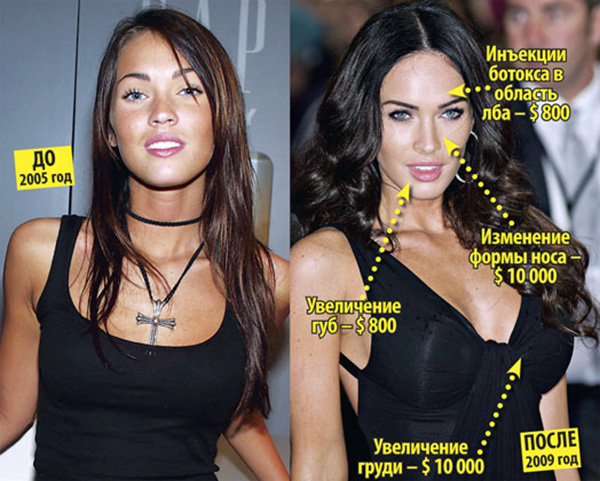 Megan Fox antes y después de la cirugía plástica facial. Foto de cuando hice cirugía plástica en labios, ojos, nariz, pómulos