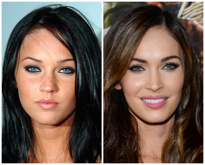 Megan Fox antes e depois da cirurgia plástica facial. Foto quando fiz cirurgia plástica nos lábios, olhos, nariz, maçãs do rosto