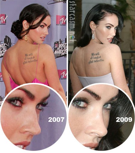 Megan Fox antes e depois da cirurgia plástica facial. Foto quando fiz cirurgia plástica nos lábios, olhos, nariz, maçãs do rosto