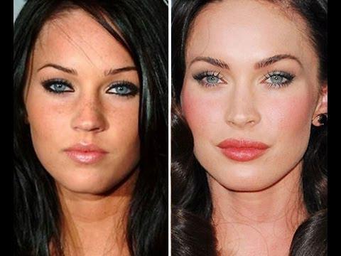 Megan Fox antes y después de la cirugía plástica facial. Foto de cuando hice cirugía plástica en labios, ojos, nariz, pómulos