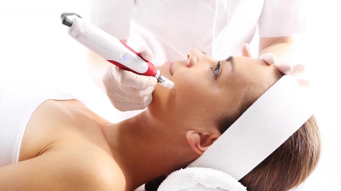 Mesotherapy of the face. What is it, injection, non-injection, photo, price of the procedure