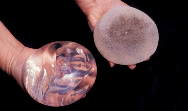 Payudara silikon. Pembedahan plastik untuk pembesaran payudara