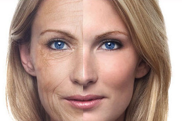 Frakční omlazení - co to je, výhody a nevýhody pro pokožku obličeje, recenze