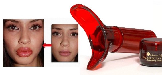 Lipcontouren - een techniek van vergroting met hyaluronzuur, vulstoffen. Foto's en prijzen