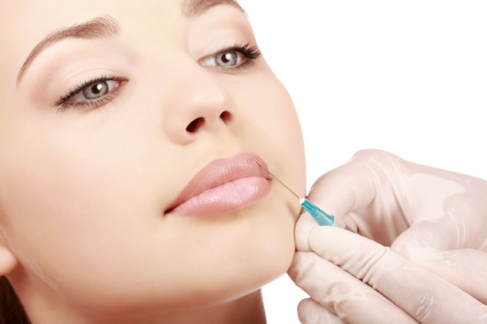 Contour des lèvres - une technique d'augmentation avec de l'acide hyaluronique, des charges. Photos et tarifs
