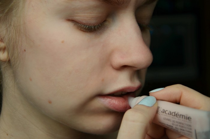 Lippenvergrößerung mit Hyaluronsäure. Fotos vor und nach dem Eingriff, Bewertungen. Wie viel kosten Injektionen?
