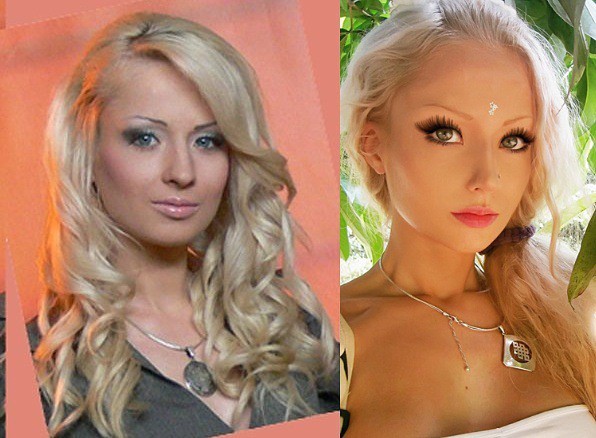 Lukyanova Valeria antes e depois dos plásticos. Foto da menina Barbie (Amatue) no Instagram, Vkontakte