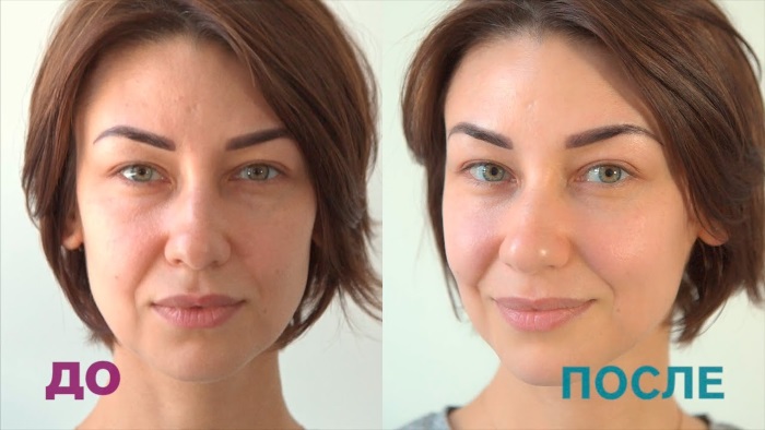 Microcorrenti per il viso in cosmetologia - una procedura di terapia dell'apparato. Prezzo, recensioni