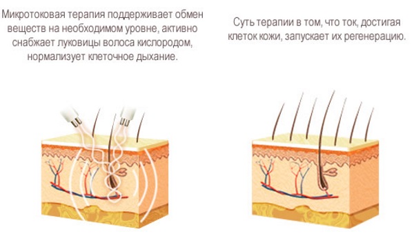 Mga microcurrent para sa mukha sa cosmetology - isang pamamaraan ng therapy ng patakaran ng pamahalaan. Presyo, repasuhin