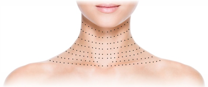 Plazmová terapie - plazmolifting kůže na obličeji a krku, indikace, kontraindikace, fotografie, cena postupu, recenze