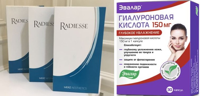 Radiesse - chuẩn bị chất làm đầy để nâng vector trong thẩm mỹ