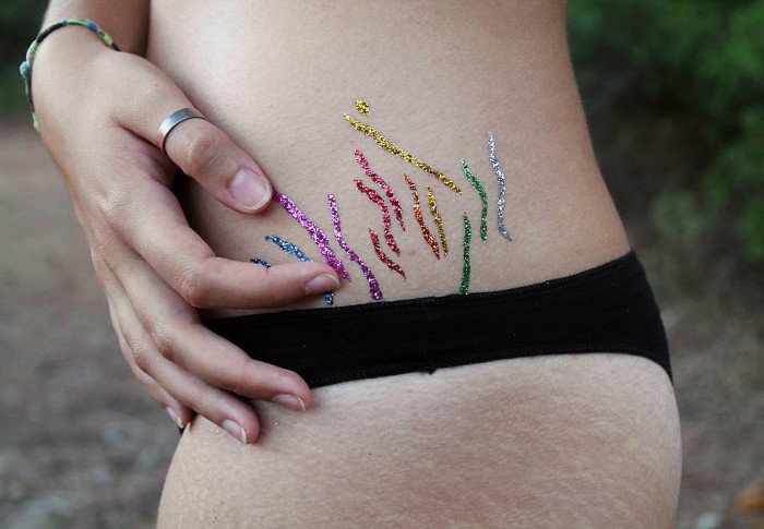 Rạn da ở phụ nữ mang thai, thanh thiếu niên trên cơ thể, bụng, ngực, chân, mông, lưng. Lý do làm thế nào để loại bỏ