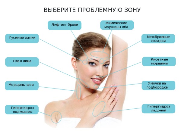 Wat is botox voor het gezicht, injecties, injecties van nano botox in het voorhoofd, nasolabiale plooien, oksels