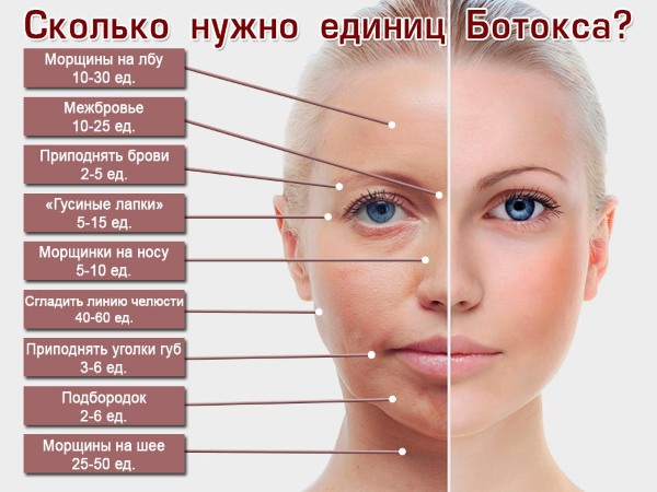 Hva er botox for ansiktet, injeksjoner, injeksjoner av nano botox i pannen, nasolabiale folder, armhuler