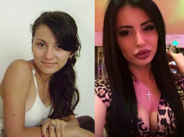 Lilia Chertraru - πριν και μετά από φωτογραφίες, βιογραφία, House 2, Instagram, VK