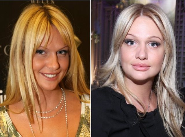 Victoria Lopyreva. Fotos abans i després de la cirurgia plàstica, creixement, biografia, vida personal, basc, Instragram