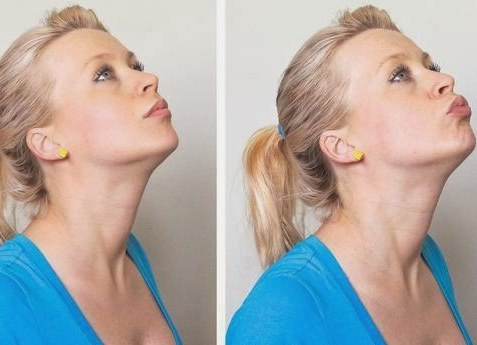 How to remove a double chin at home in a week. Exercise or surgery, masks, massage