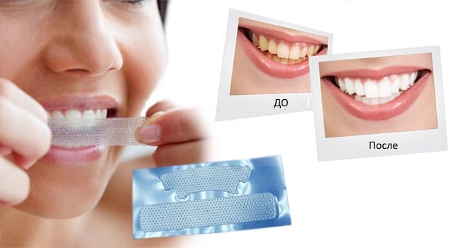 Hur man vitnar tänderna hemma utan att skada emaljen snabbt från gulhet. Produkter och folkrecept