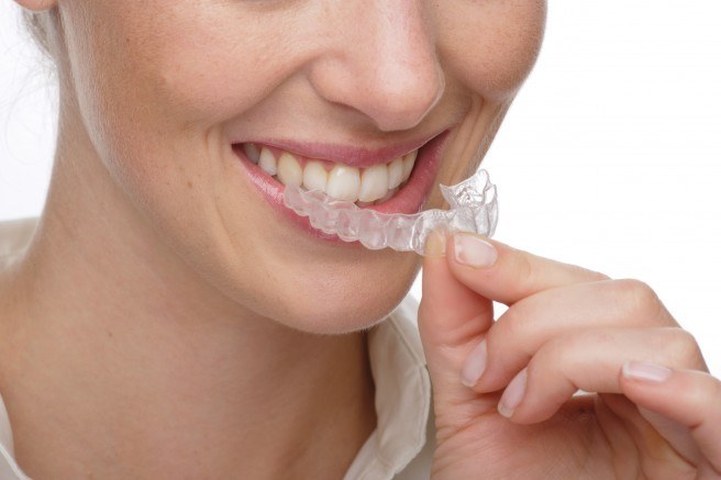 Cách làm trắng răng tại nhà không gây hại cho men răng khỏi ố vàng nhanh chóng. Sản phẩm và công thức dân gian