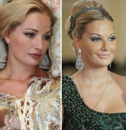 Maria Maksakova antes y después de la foto de la cirugía plástica. Biografía y vida personal, hijos del cantante de ópera. Cirugía plástica