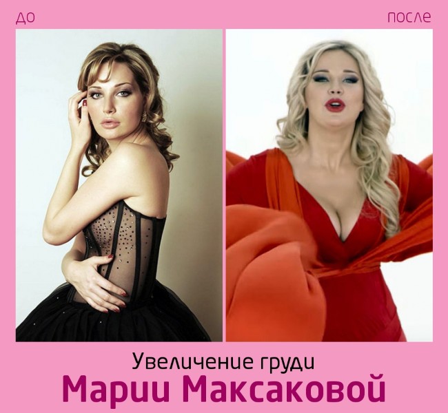 Maria Maksakova abans i després de la fotografia de cirurgia plàstica. Biografia i vida personal, fills d’un cantant d’òpera. Cirurgia Plàstica