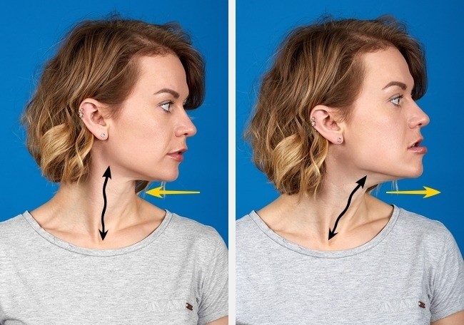 Lifting lica - korekcija oblika lica bez operacije, u salonu. Fotografije prije i poslije