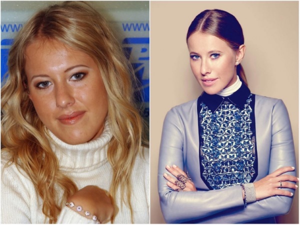 Estrelles abans i després de les fotos de cirurgia plàstica, rinoplàstia en celebritats