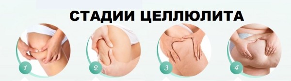 Massatge anticel·lulític a casa. Com es pot fer per aprimar l’abdomen, les cames, les natges i altres parts del cos. Instruccions pas a pas amb fotografia