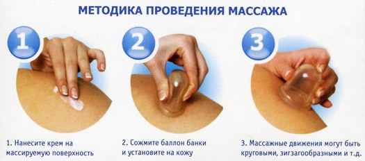 Антицелулитна масажа вакуумским чашама код куће. Како то правилно учинити, техника, контраиндикације, резултати и фотографије