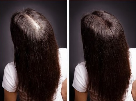 Ampule na vlasy Eucapil - složení, návod k použití, výsledky použití u žen a mužů. Cena, recenze a kde koupit produkt