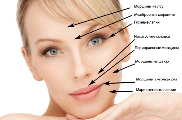 Hyaluronzuur voor het gezicht: hoe de injecties worden uitgevoerd, resultaten, foto's voor en na injecties, beoordelingen