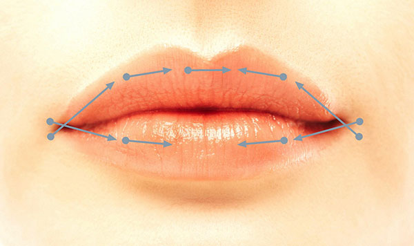 Hyaluronsäure auf den Lippen - vor und nach Fotos, wie lange die Wirkung anhält, Kontraindikationen
