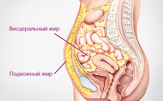 Comment se débarrasser de la graisse viscérale du ventre chez les hommes et les femmes. Exercice et autres moyens