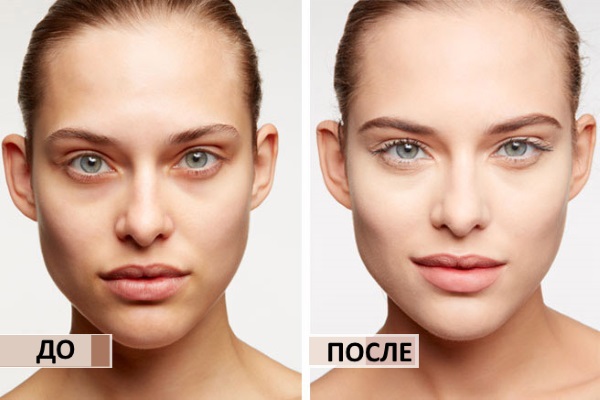 Hur man minskar näsan, omformar sig utan operation, visuellt med smink, korrigerare, kosmetika, övningar och injektioner