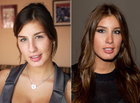 Katie Topuria - φωτογραφία πριν και μετά την πλαστική χειρουργική. Τι πράξεις έκανε το αστέρι, πόσο και πώς άλλαξε η εμφάνισή της