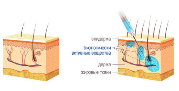 Mezoterapija plaukams - kas tai yra kosmetologijoje, kaip ji daroma, kokie vaistai vartojami. Nuotraukos ir apžvalgos