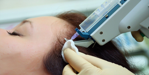 Mesoterapi untuk rambut - apa itu dalam kosmetologi, bagaimana ia dilakukan, ubat apa yang digunakan. Foto dan ulasan