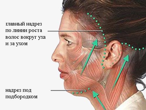 Căng da mặt trái xoan - nâng cơ, kem dưỡng da, chỉ, đắp mặt nạ, tập tại nhà. Một bức ảnh