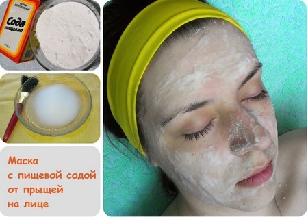 Cicatrices sur le visage après l'acné - comment se débarrasser de: crèmes, pommades, produits pharmaceutiques, masques, méthodes cosmétiques et médicales